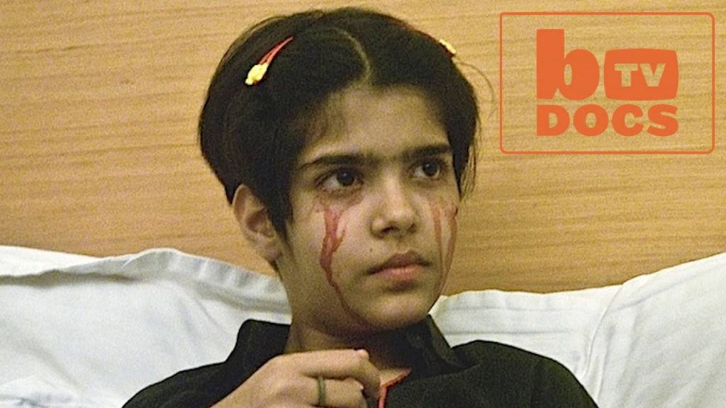 Медицината нема одговор: Девојче од Индија плаче крв