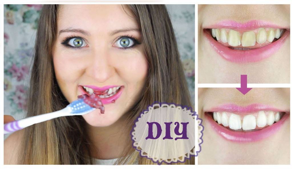 10 ТРИКОВИ: Избелете ги забите ВЕДНАШ!