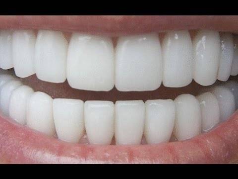 Користејќи го овој трик ќе добиете бели заби за само 180 секунди – сè е природно