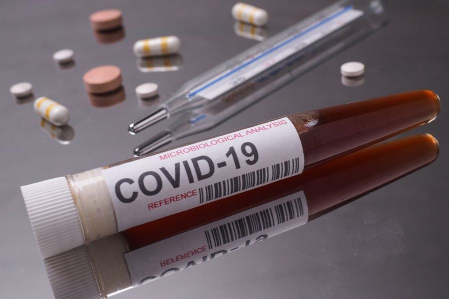 Covid-19 coronavirus lab test with label on test tube