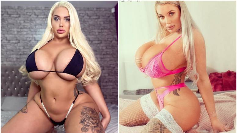 операција операција