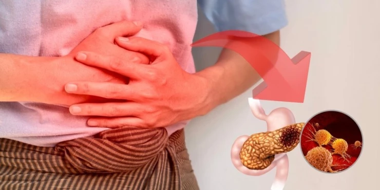 Невидливи знаци на рак на панкреас