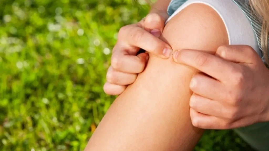 Лекарите предупредуваат: Оваа честа грешка при отстранување на крлежи може да биде опасна