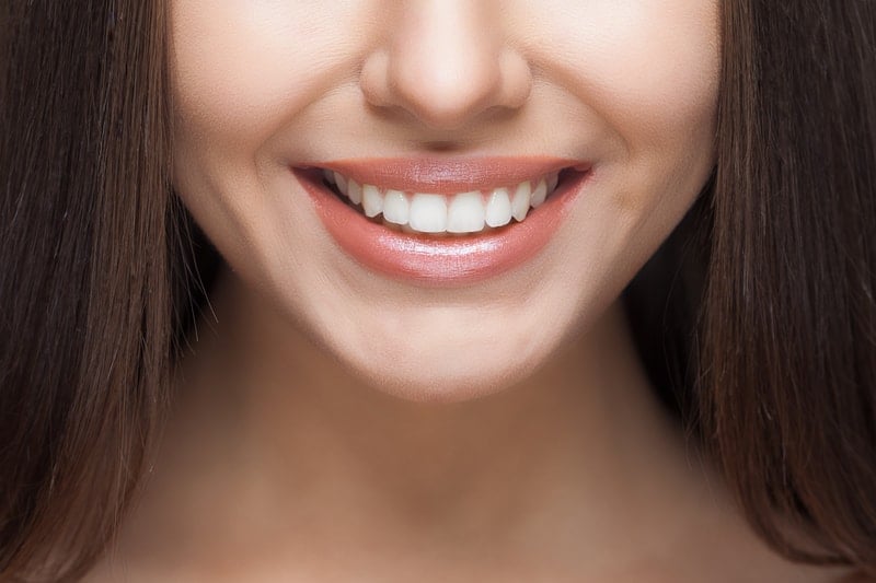beautiful-white-teeth-and-smile-from-professional-teeth-whitening-in-ottawa beautiful-white-teeth-and-smile-from-professional-teeth-whitening-in-ottawa